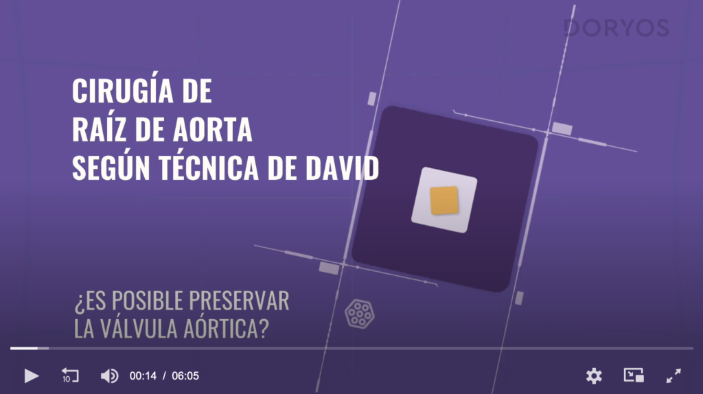 Cirugía de raíz de aorta según técnica de David